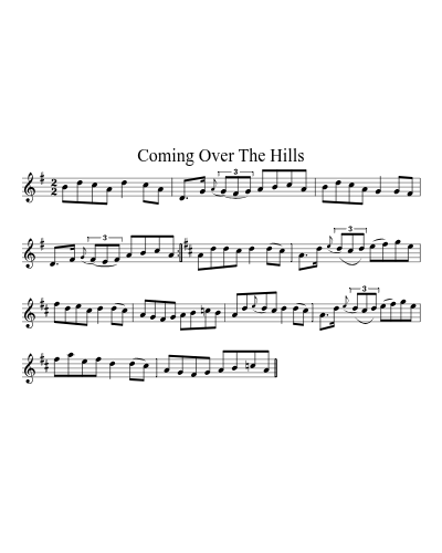 Coming Over The Hills (Version 2) preview