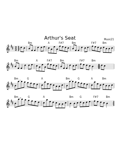 Arthur's Seat (Version 2)