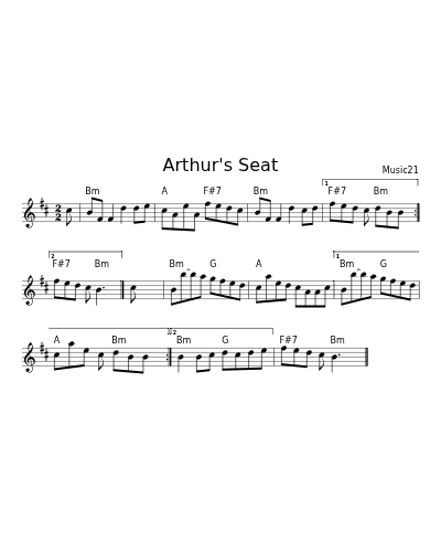 Arthur's Seat (Version 3)