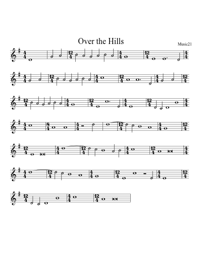 Over the Hills (Version 2) preview