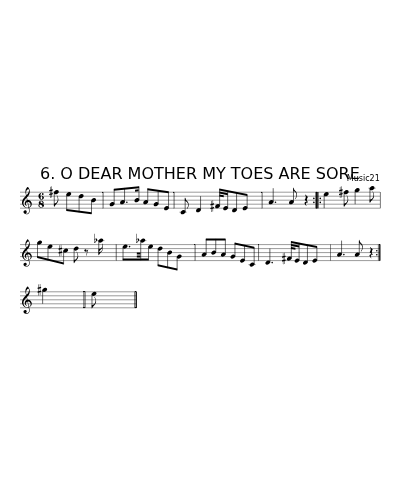 6. O DEAR MOTHER MY TOES ARE SORE