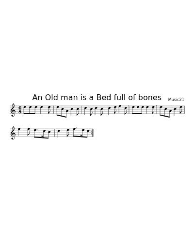 An Old man is a Bed full of bones