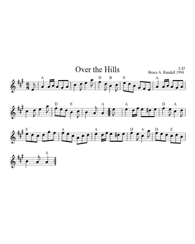 Over the Hills (Version 3) preview