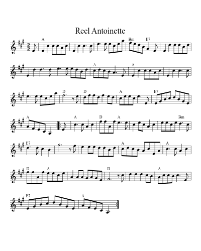 Reel Antoinette (Version 2)