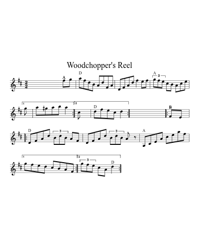 Woodchopper's Reel (Version 7)